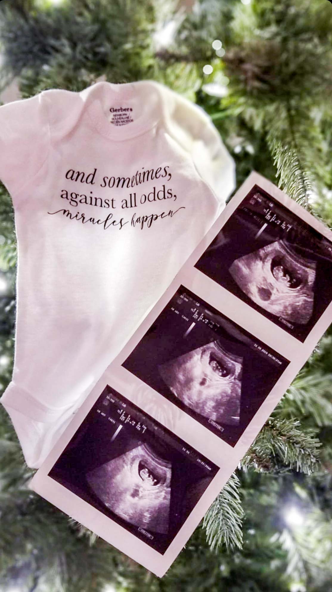 Mosie Baby announcement with sonograms and baby onesie in front of tree. Onesie reads "and sometimes, against all odds, miracles happen."