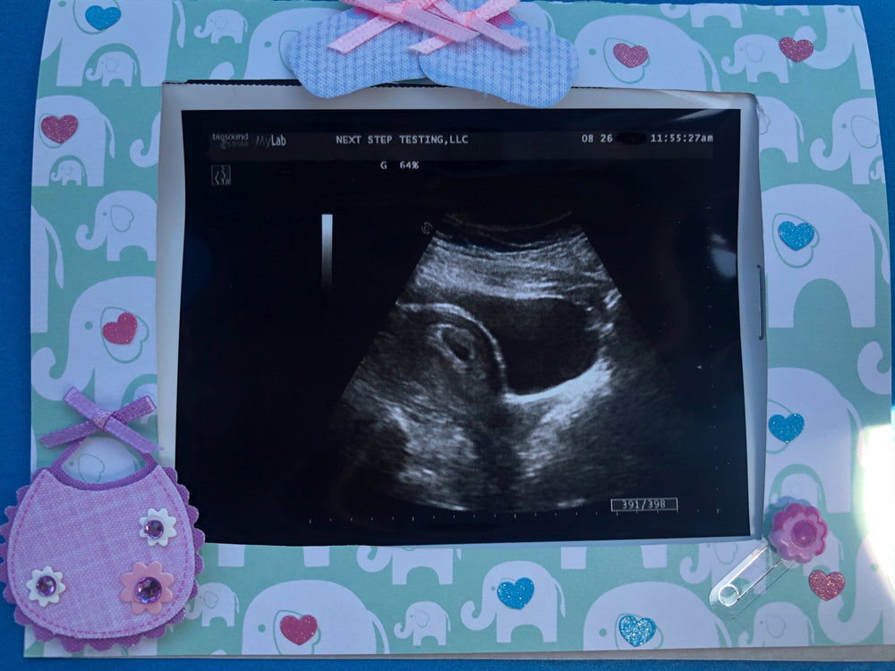 sonogram of a Mosie Baby with colorful scrapbook border frame