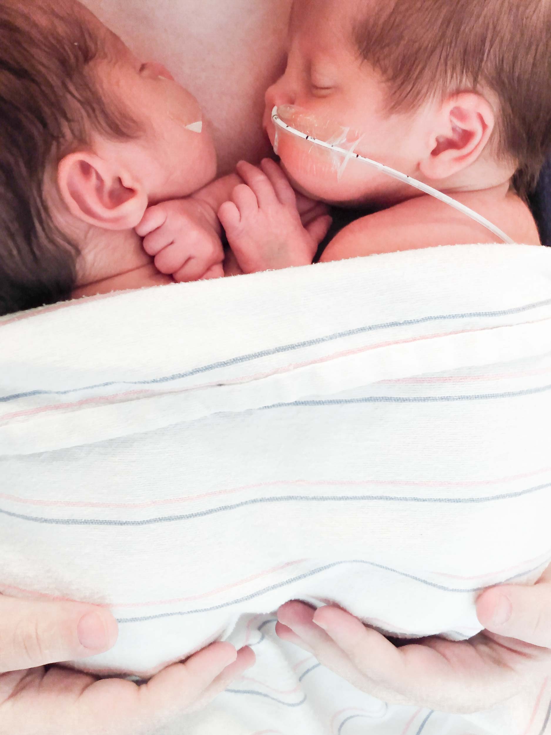 Newborn twins with tubes in their nose are sleeping closely on their mother's chest and being supported by her hands under a hospital baby blanket.
