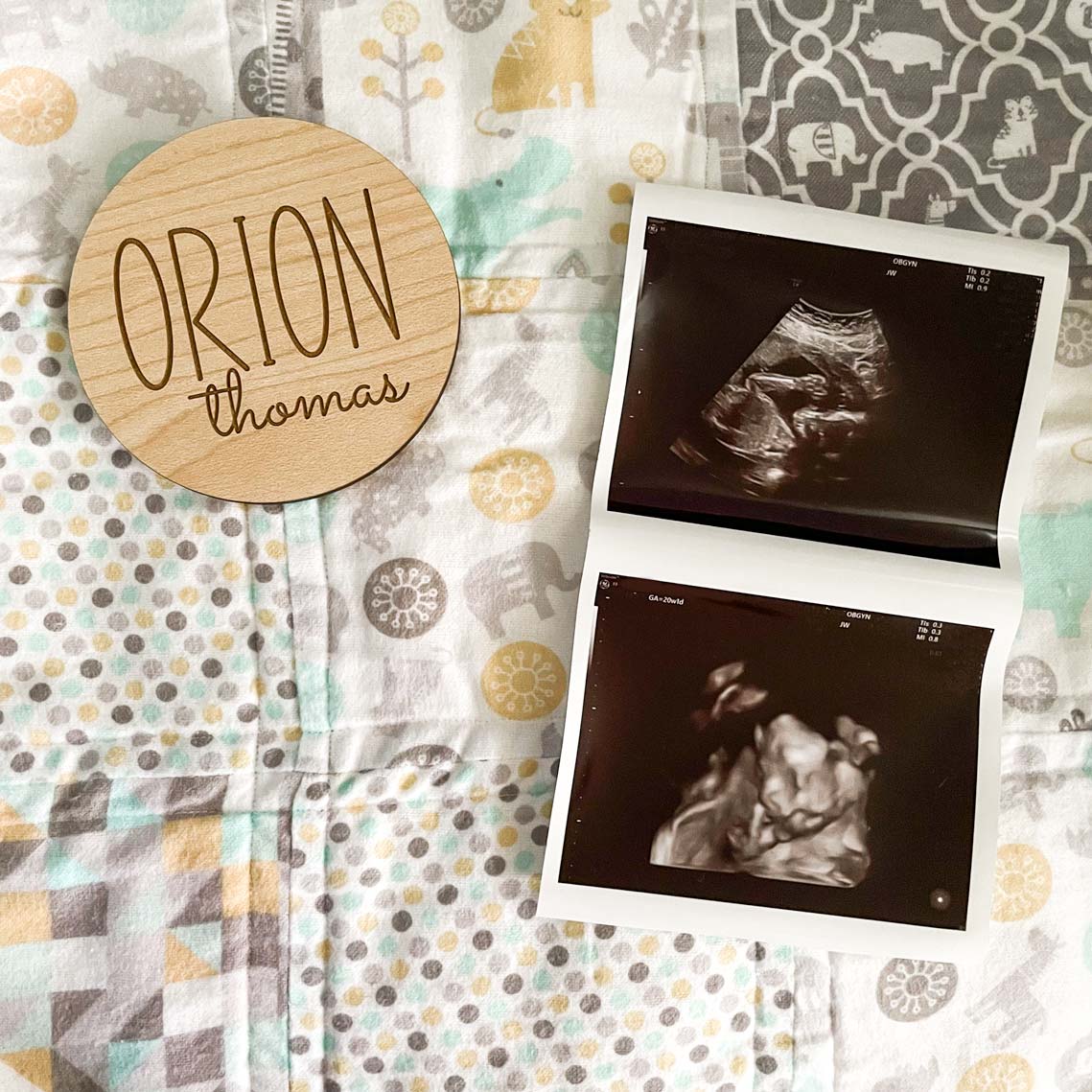 Wooden name sign read Orion Thomas, laying next two two sonogram images on baby blanket.