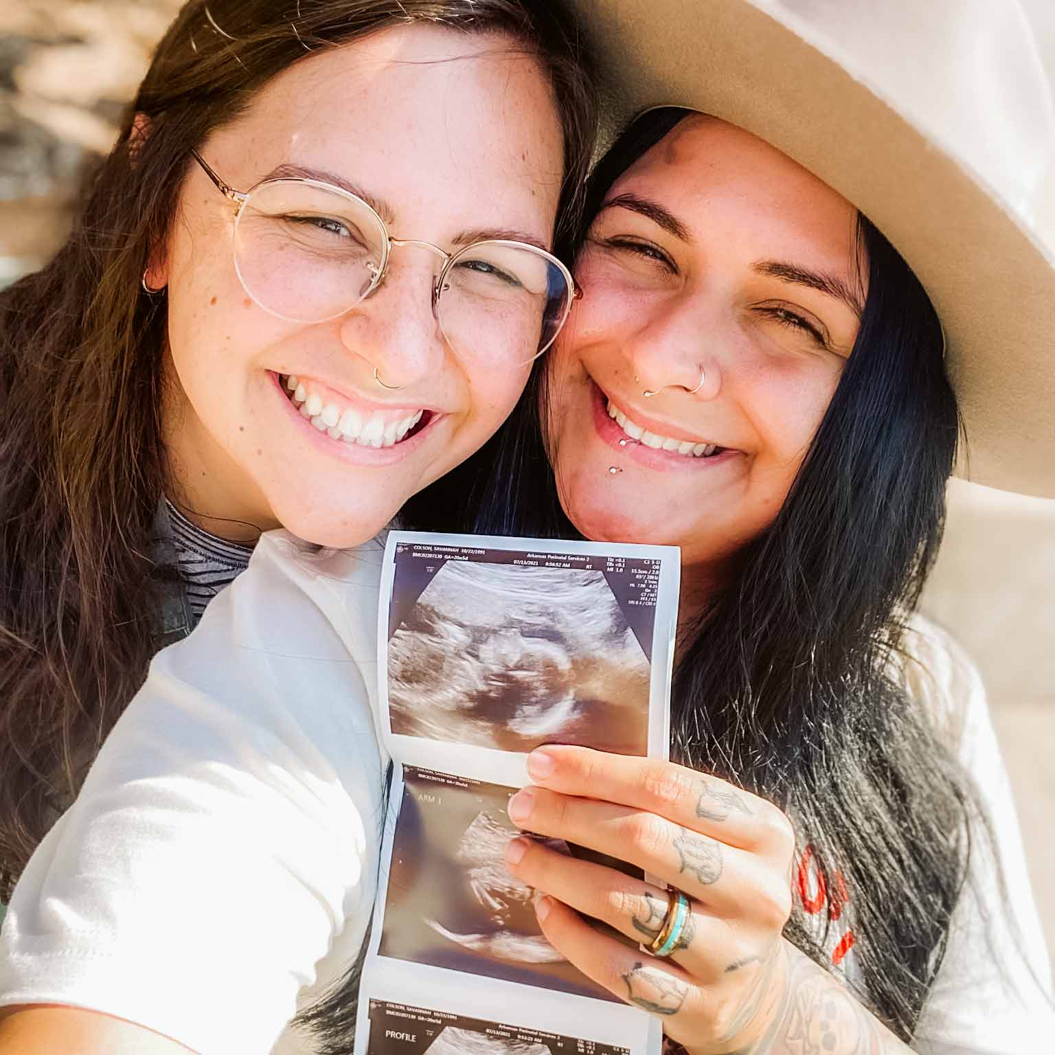 Mosie Mamas-to-be share pregnancy announcement with sonogram with bright smiles!