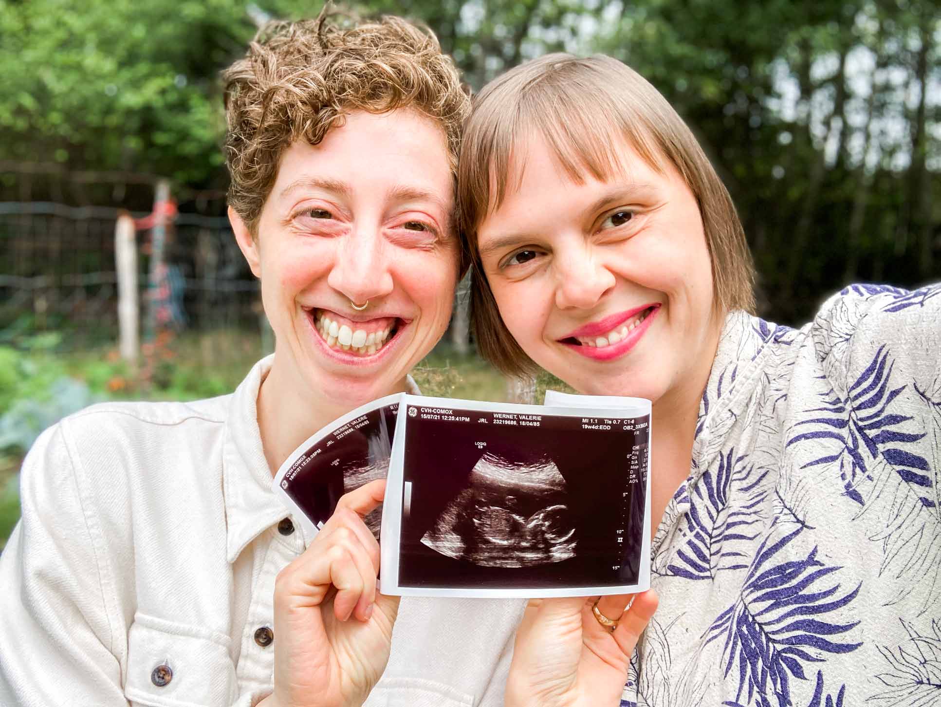 Two smiling women happily holds up their sonogram photo announcing they are pregnant.