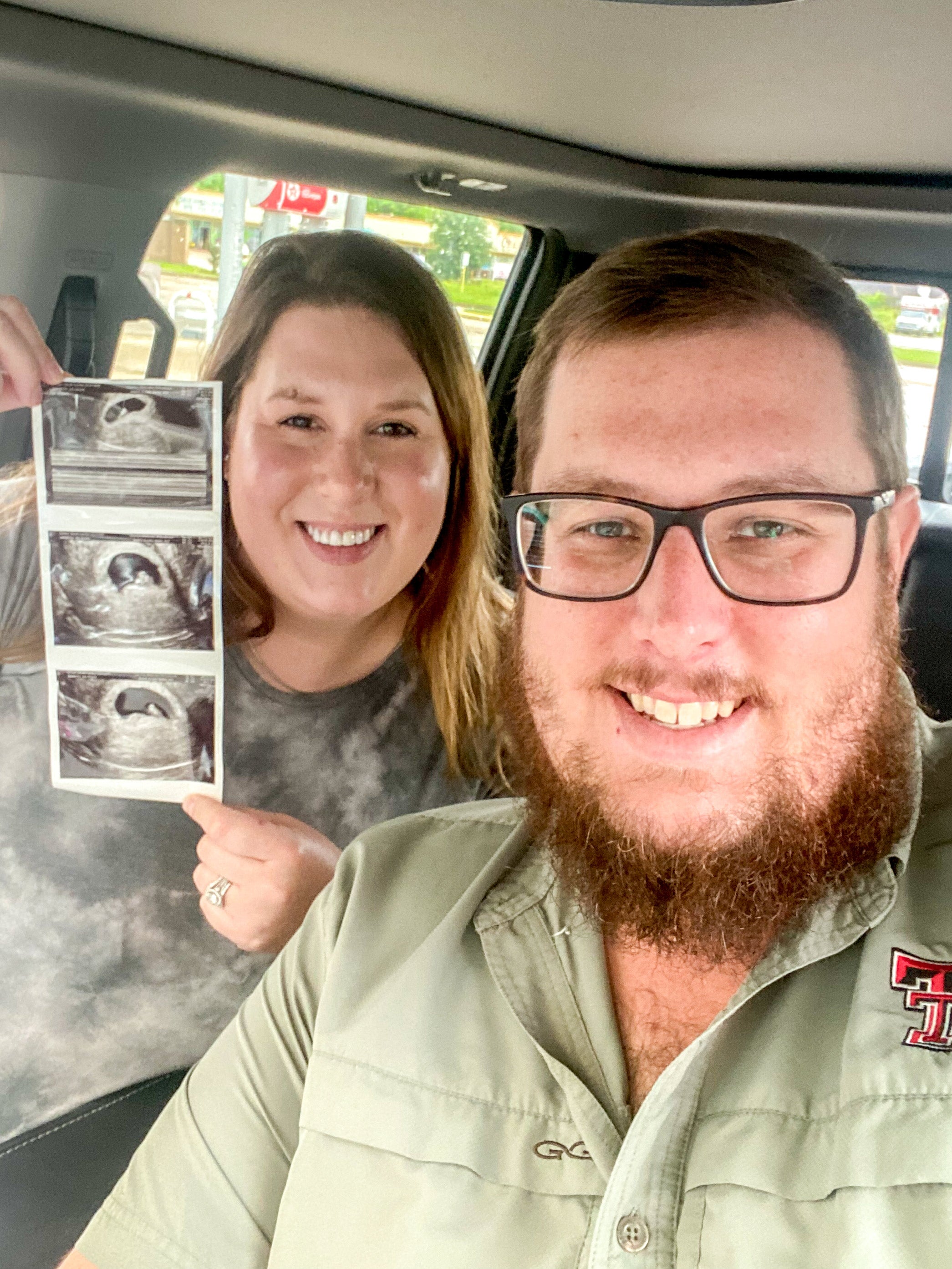 Man and Woman share sonogram of their Mosie Baby in car