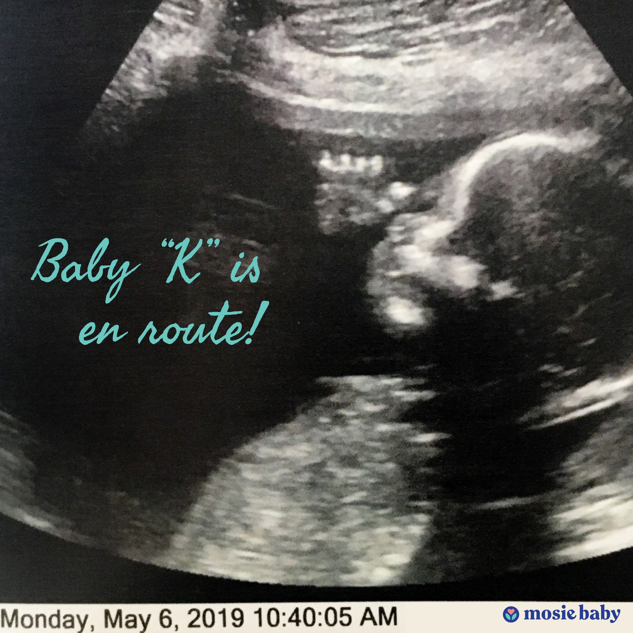 a sonogram of a mosie baby