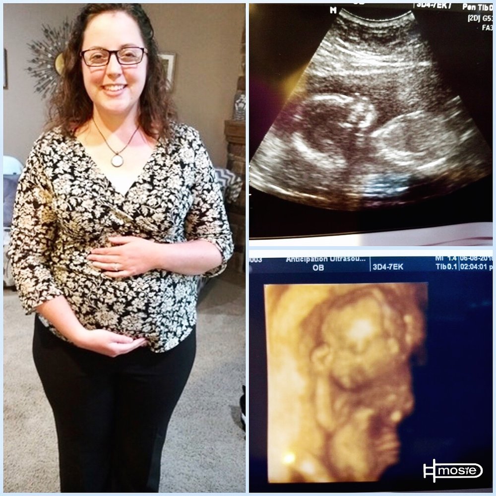 A pregnant woman, a sonogram, and a 3-D ultrasound in a collage