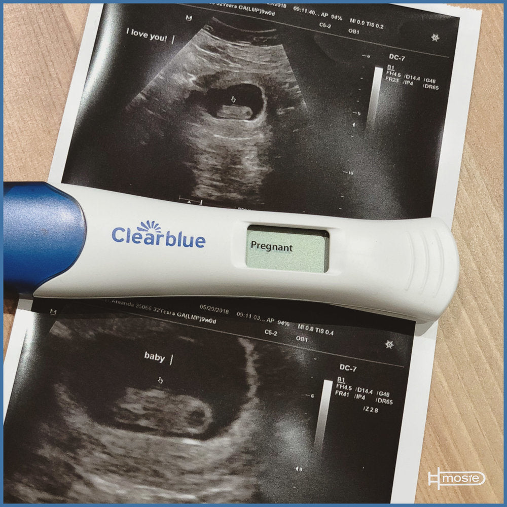 a positive pregnancy test on top of a sonogram of a mosie baby