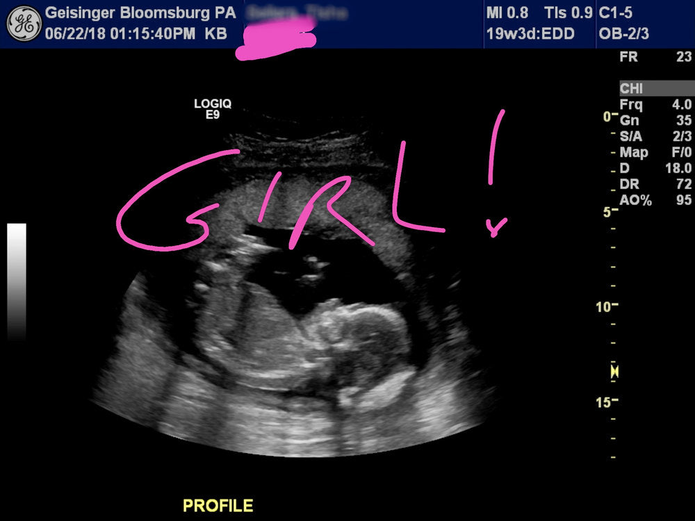 sonogram of a baby mosie girl