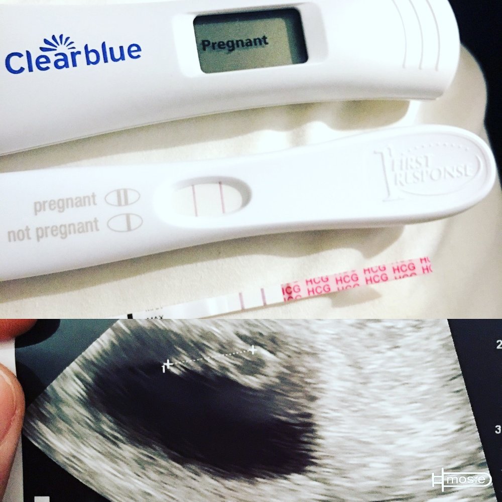 three positive pregnancy tests and sonogram from a Mosie user